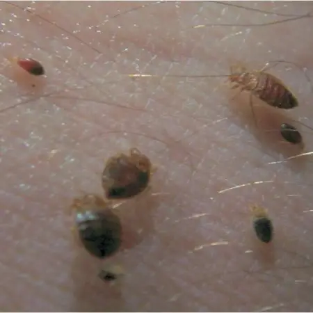 Bed Bugs In Skin